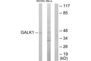 Western Blotting (WB) image for anti-Galactokinase 1 (GALK1) (N-Term) antibody (ABIN1849417) (GALK1 抗体  (N-Term))