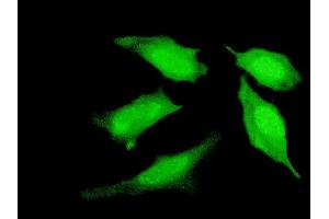 Immunofluorescence of monoclonal antibody to PRDM4 on HeLa cell. (PRDM4 抗体  (AA 476-575))