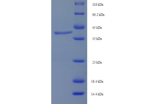 LHCGR Protein (AA 27-363) (His tag)