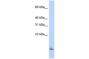WB Suggested Anti-SCGB1A1 Antibody Titration:  0. (SCGB1A1 抗体  (Middle Region))