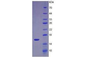 Image no. 1 for UDP-Glucose Ceramide Glucosyltransferase (UGCG) (AA 39-171) protein (His tag) (ABIN4988832) (UGCG Protein (AA 39-171) (His tag))