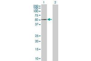 Lane 1: ACP6 transfected lysate ( 47. (ACP6 293T Cell Transient Overexpression Lysate(Denatured))