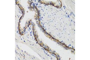 Immunohistochemistry of paraffin-embedded human prostate using ATP1A1 antibody (ABIN1871152) at dilution of 1:100 (40x lens). (ATP1A1 抗体)