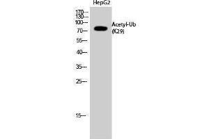 Western Blotting (WB) image for anti-Ubiquitin (Ubiquitin) (acLys29) antibody (ABIN3181497) (Ubiquitin 抗体  (acLys29))
