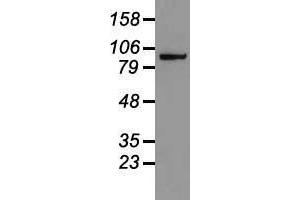 Western blot analysis of 35 µg of cell extracts from human colon adenocarcinoma (HT29) cells using anti-CTNNB1 antibody. (CTNNB1 抗体  (AA 531-781))