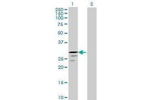 Lane 1: TRY1 transfected lysate ( 27. (TRY1 293T Cell Transient Overexpression Lysate(Denatured))