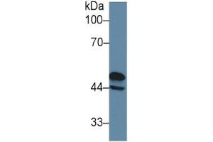 Western Blotting (WB) image for Glial Fibrillary Acidic Protein (GFAP) ELISA Kit (ABIN6574132)