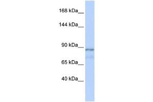 WB Suggested Anti-ZFAT1 Antibody Titration:  0. (ZFAT 抗体  (Middle Region))