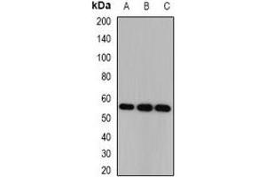 Western blot analysis of CSN1 expression in HEK293T (A), SKOV3 (B), mouse brain (C) whole cell lysates. (GPS1 抗体)