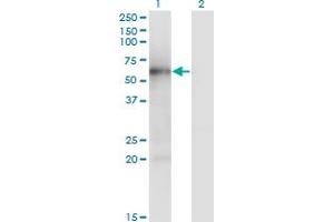 Western Blot analysis of MKNK1 expression in transfected 293T cell line by MKNK1 monoclonal antibody (M04), clone 5E12. (MKNK1 抗体  (AA 1-465))