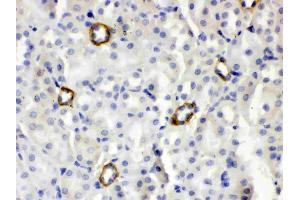 IHC analysis of ISG15/Ucrp using anti- ISG15/Ucrp antibody . (ISG15 抗体  (AA 2-155))