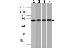 Image no. 1 for anti-DEAD (Asp-Glu-Ala-Asp) Box Polypeptide 3, X-Linked (DDX3X) (AA 10-230) antibody (ABIN5027139) (DDX3X 抗体  (AA 10-230))
