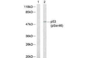 Western blot analysis of extracts from 293 cells, using p53 (phospho-Ser46) antibody (E011099). (p53 抗体  (pSer46))