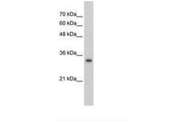 ZNF227 抗体  (AA 301-350)