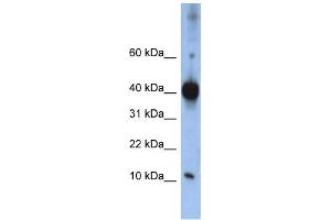 Western Blotting (WB) image for anti-LSM4 Homolog, U6 Small Nuclear RNA Associated (LSM4) antibody (ABIN2458525) (LSM4 抗体)