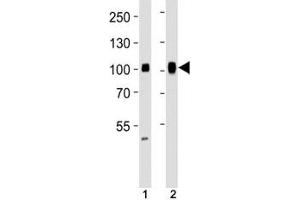 Western blot analysis of lysate from (1) HeLa and (2) Ramos cell line using SP1 antibody at 1:1000. (SP1 抗体)