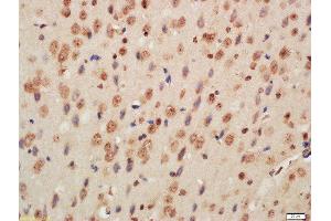 Formalin-fixed and paraffin embedded mouse brain labeled with Rabbit Anti-Histone H3 (Di Methyl K9) Polyclonal Antibody, Unconjugated  at 1:200 followed by conjugation to the secondary antibody and DAB staining (Histone 3 抗体  (H3K9me))