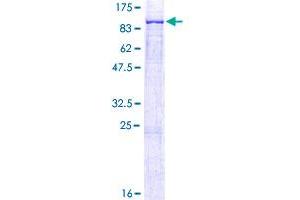 ALOX12B Protein (AA 1-701) (GST tag)