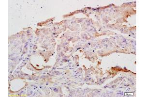 Formalin-fixed and paraffin embedded rat testis labeled with Rabbit Anti PAPK/ALS2CR2 Polyclonal Antibody, Unconjugated (ABIN751273) at 1:200 followed by conjugation to the secondary antibody and DAB staining (STRADB 抗体  (AA 251-350))