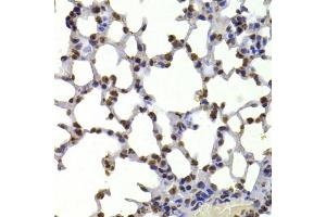 Immunohistochemistry of paraffin-embedded mouse lung using CBX5 antibody. (CBX5 抗体)