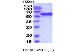 SDS-PAGE (SDS) image for Prolyl 4-Hydroxylase, beta Polypeptide (P4HB) (AA 20-509) (Active) protein (His tag) (ABIN5854508) (P4HB Protein (AA 20-509) (His tag))