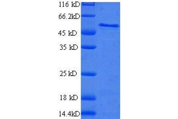 BCAP31 Protein (AA 2-243, partial) (GST tag)