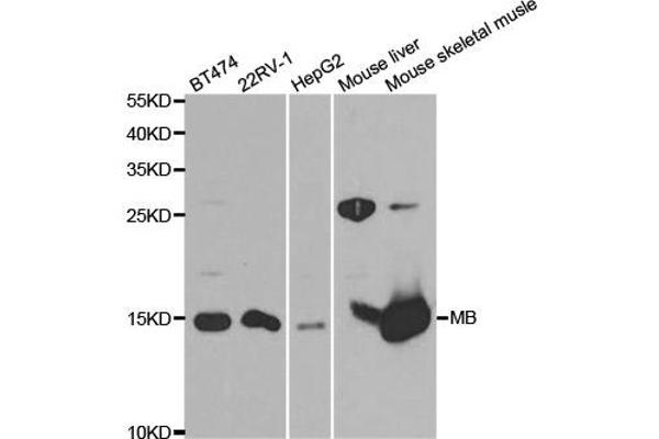 MB 抗体