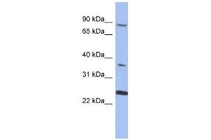 MPP3 antibody used at 1 ug/ml to detect target protein. (MPP3 抗体)