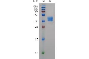 Mouse Protein, hFc Tag on SDS-PAGE under reducing condition. (CCR8 Protein (AA 1-33) (Fc Tag))