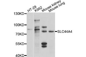 Western blot analysis of extracts of various cell lines, using SLC44A4 antibody (ABIN4905203) at 1:1000 dilution. (SLC44A4 抗体)