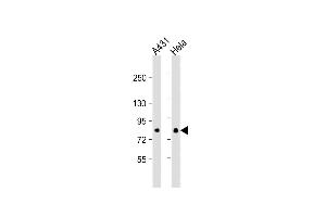 All lanes : Anti- EIF4B Antibody at 1:1000 dilution Lane 1: A431 whole cell lysate Lane 2: Hela whole cell lysate Lysates/proteins at 20 μg per lane. (EIF4B 抗体)