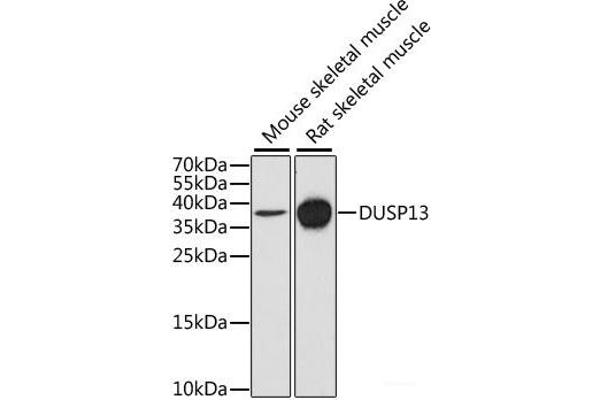 DUSP13 抗体