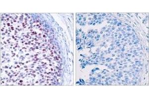 Immunohistochemistry (IHC) image for anti-Jun Proto-Oncogene (JUN) (pThr239) antibody (ABIN2888454) (C-JUN 抗体  (pThr239))