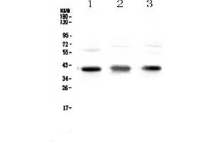 Western blot analysis of CCR4 using anti-CCR4 antibody . (CCR4 抗体)