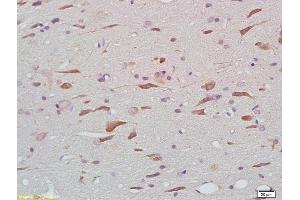 Formalin-fixed and paraffin embedded rat brain tissue labeled with Anti-phospho-Tau protein(Thr205) Polyclonal Antibody, Unconjugated (ABIN801813) at 1:200 followed by conjugation to the secondary antibody (tau 抗体  (pThr212))