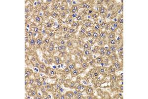 Immunohistochemistry of paraffin-embedded rat liver using UBE2J2 antibody (ABIN4905538) at dilution of 1:100 (40x lens). (UBE2J2 抗体)