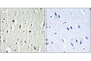 Immunohistochemistry (IHC) image for anti-C-Src tyrosine Kinase (CSK) (AA 330-379) antibody (ABIN2888621) (CSK 抗体  (AA 330-379))