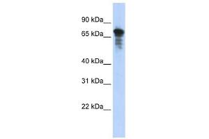 RHPN1 antibody used at 1 ug/ml to detect target protein. (RHPN1 抗体  (Middle Region))