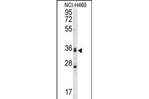 MBNL3 Antibody (Center) (ABIN657004 and ABIN2846185) western blot analysis in NCI- cell line lysates (35 μg/lane). (MBNL3 抗体  (AA 251-280))