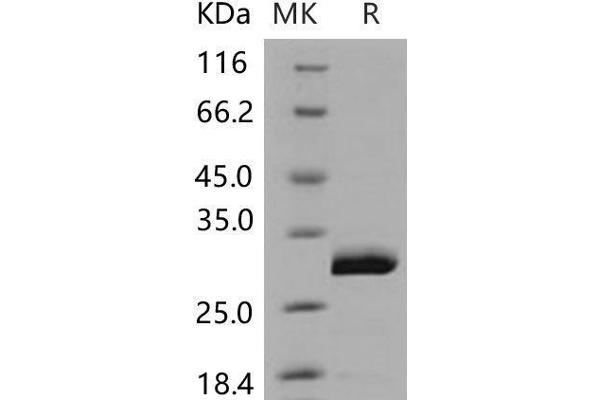 UCHL3 Protein (His tag)