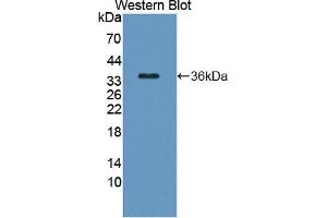 Detection of Recombinant TAK1L, Human using Polyclonal Antibody to TAK1 Like Protein (TAK1L) (MAP3K7CL 抗体  (AA 1-242))
