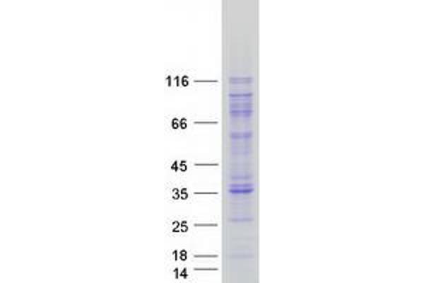 AARS Protein (Myc-DYKDDDDK Tag)