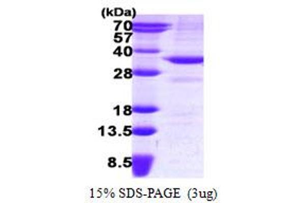 BDH1 Protein (AA 47-343) (His tag)