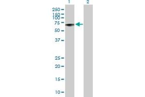 Western Blot analysis of MMP13 expression in transfected 293T cell line by MMP13 MaxPab polyclonal antibody. (MMP13 抗体  (AA 1-471))