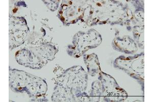 Immunostaining (ISt) image for anti-Ubiquitin-Conjugating Enzyme E2C (UBE2C) (AA 70-179) antibody (ABIN564800)