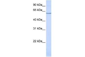 WB Suggested Anti-SLC1A1 Antibody Titration:  0. (SLC1A1 抗体  (N-Term))