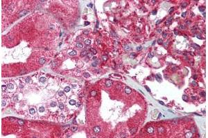 Human Kidney (formalin-fixed, paraffin-embedded) stained with XBP1 antibody ABIN214020 at 5 ug/ml followed by biotinylated goat anti-rabbit IgG secondary antibody ABIN481713, alkaline phosphatase-streptavidin and chromogen. (XBP1 抗体  (C-Term))