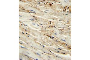 immunohistochemistry analysis in formalin fixed and paraffin embedded mouse heart tissue followed by peroxidase conjugation of the secondary antibody and DAB staining. (Endoglin 抗体  (AA 380-409))