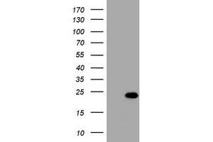 Image no. 1 for anti-Visinin-Like 1 (VSNL1) (AA 2-191) antibody (ABIN1491144) (VSNL1 抗体  (AA 2-191))