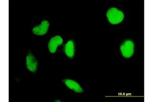 Immunofluorescence of monoclonal antibody to IRF2 on HeLa cell. (IRF2 抗体  (AA 216-315))